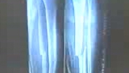 中国骨伤学