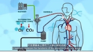 ECMO